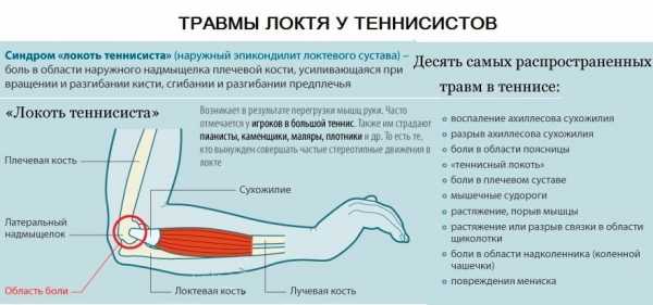 Латеральный эпикондилит локтевого сустава симптомы и лечение фото