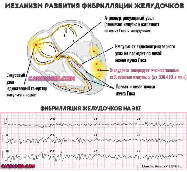 Одышка на фоне сердечной недостаточности