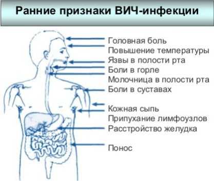 Лечение вич картинки