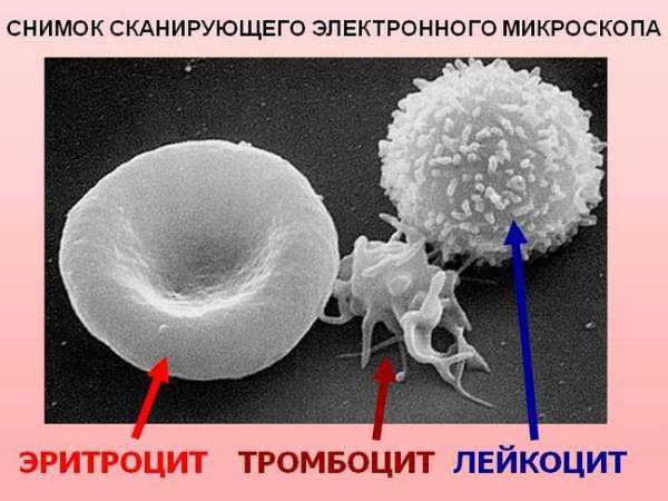 Лейкоциты в стуле грудничка