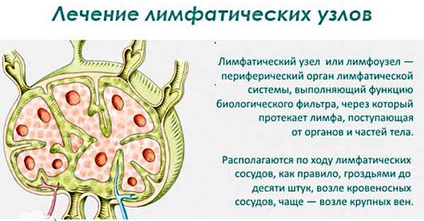 Забрюшинные лимфоузлы фото где находятся