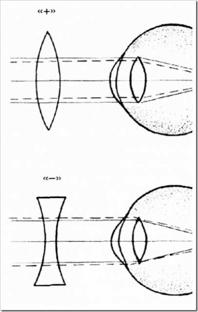 На рисунках изображено несколько линз при близорукости можно применять