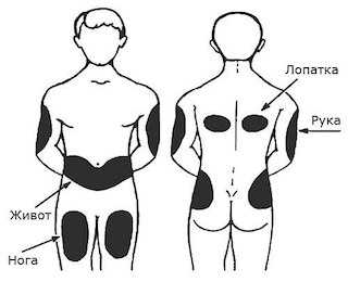Куда колоть инсулин собаке фото