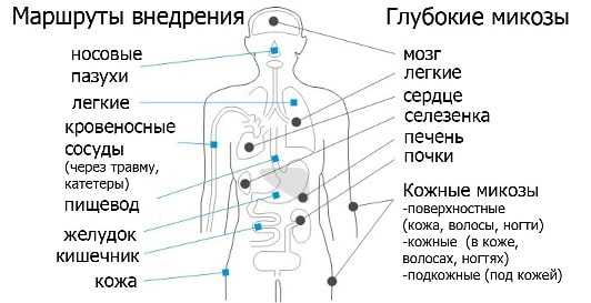 Системный микоз фото