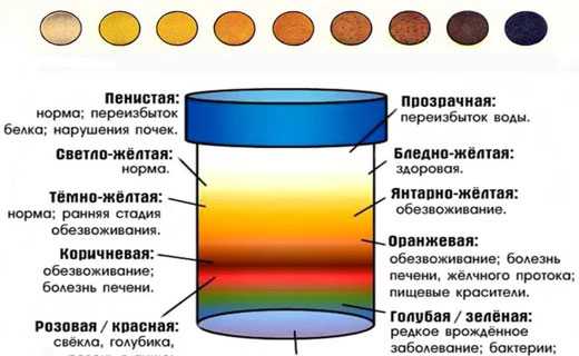 Какая должна быть моча у здорового человека цветом фото