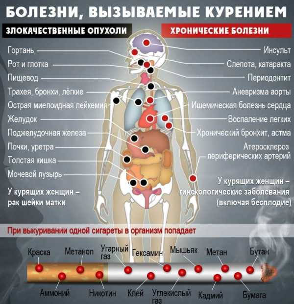 Фото флюорографии здорового человека женщины