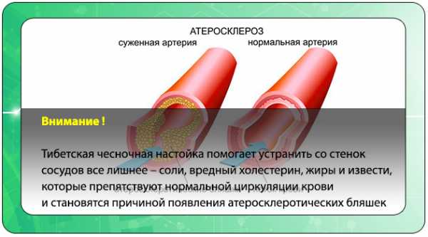 Схема приема чесночной настойки для очищения сосудов