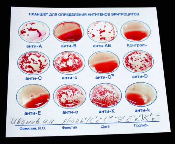 Группа крови рисунок