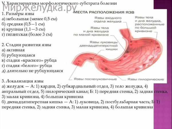 Перфоративная язва презентация