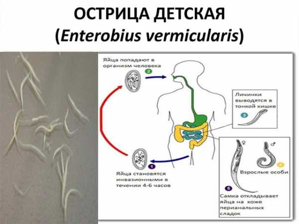 Схема лечения остриц