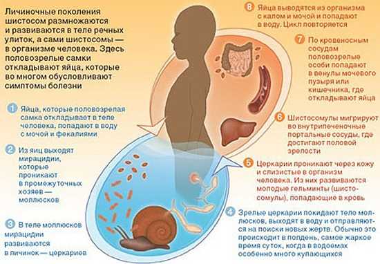 Паразитарные заболевания фото