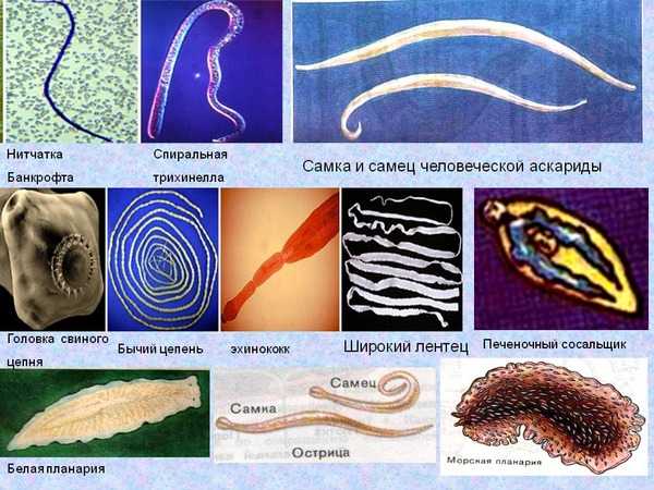 Паразиты в кишечнике фото и описание
