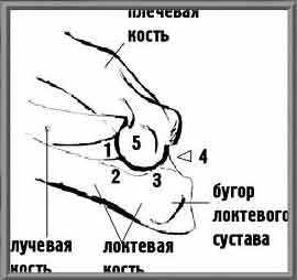 Венечный отросток локтевой кости фото