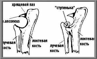 Венечный отросток локтевой кости фото