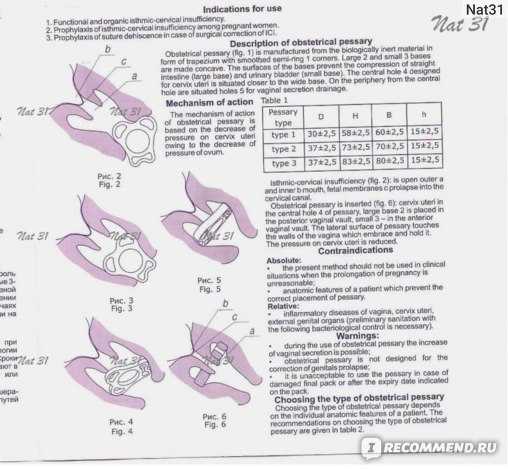 После установки пессария какой образ жизни вести