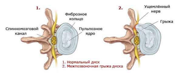 Где находится позвонок l5 в пояснице фото