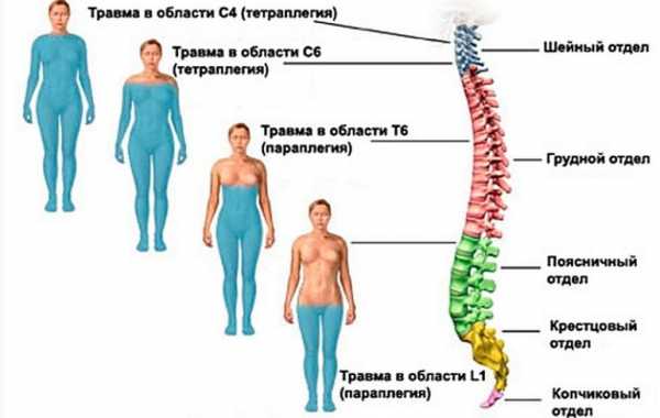 Где находится позвонок l5 в пояснице фото