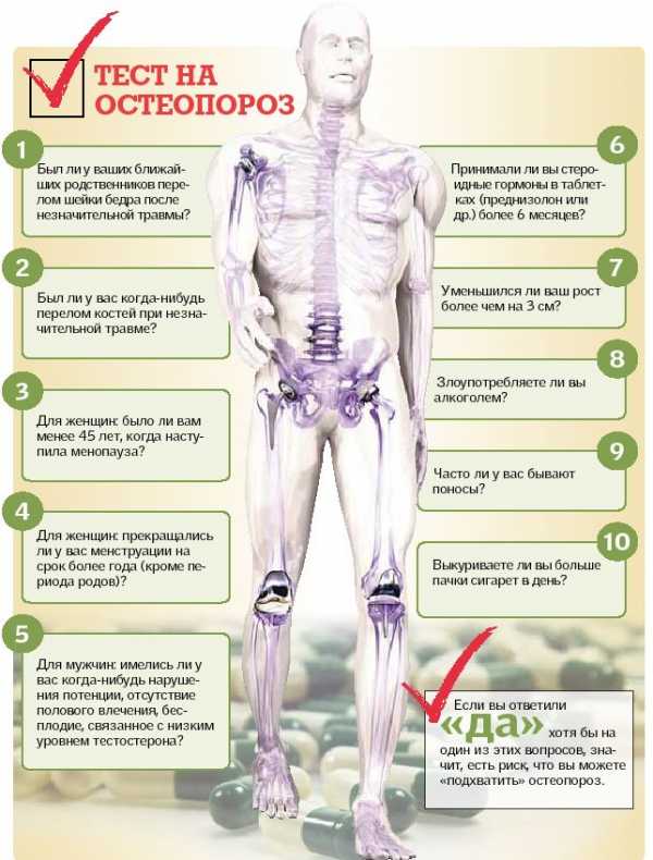Остеопороз симптомы и лечение у женщин после 60 признаки и лечение фото