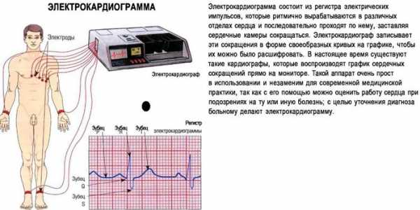 Сердечная недостаточность карта вызова