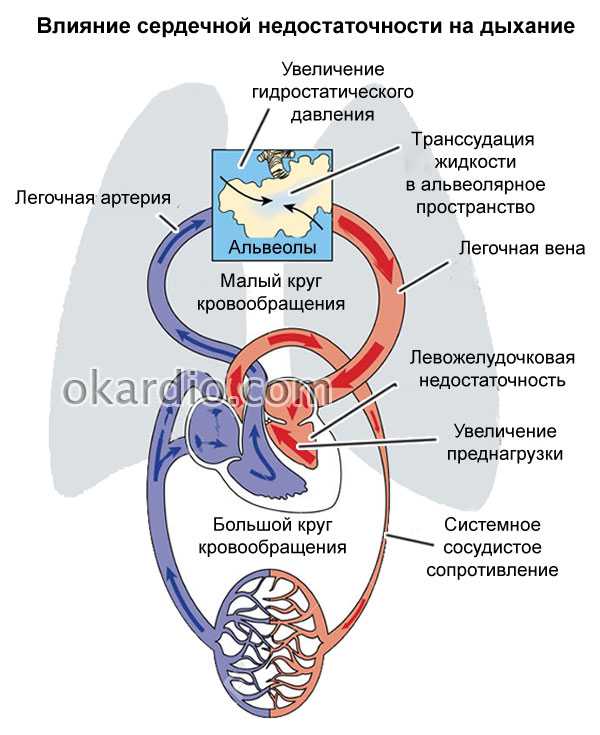 Схема недостаточность кровообращения