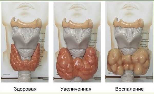 Где щитовидная железа фото у мужчин