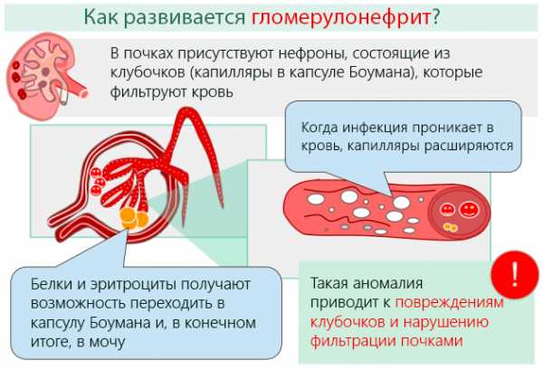 Сбор мочи по зимницкому картинки