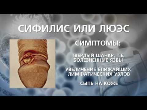 Первичный сифилис картинки