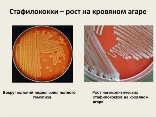 Staphylococcus Haemolyticus в мазке у мужчин Staphylococcus