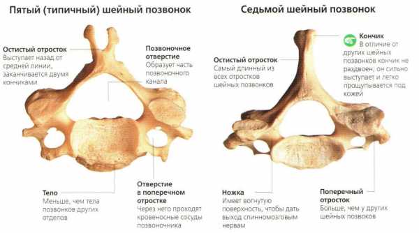 Свищ на спине у человека фото