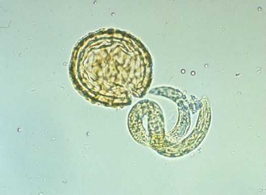 Аскариды откладывают яйца. Ascaris lumbricoides яйца микроскоп. Яйца аскариды под микроскопом. Яйца аскариды человеческой неоплодотворенное.