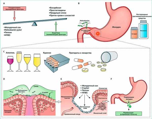 Язва двенадцатиперстной кишки лечение препараты схема лечения