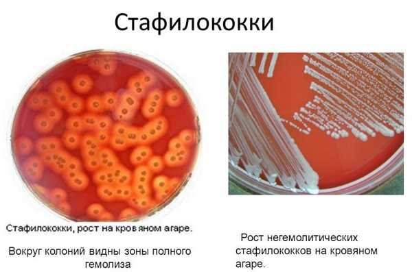 Золотистый стафилококк презентация